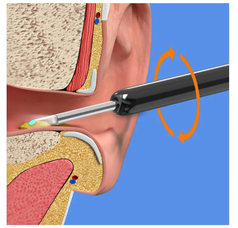 Earwax Removal Cleaning Kit | مجموعة تنظيف شمع الأذن